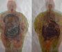 La exposición Incómoda mirada a un cuerpo con recuerdos invita a reflexionar sobre la obesidad
